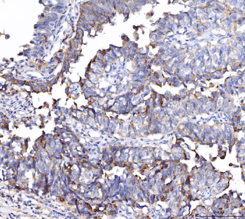 Anti-CD55 Antibody (monoclonal, 5B9E1)