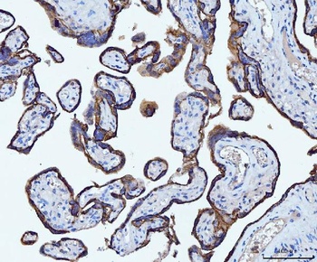 CD55 Antibody (monoclonal, 5B9E1)