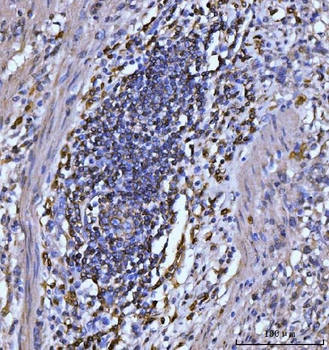 Anti-CD20 Antibody (monoclonal, 4D11)