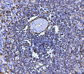 Anti-CD20 Antibody (monoclonal, 4D11)