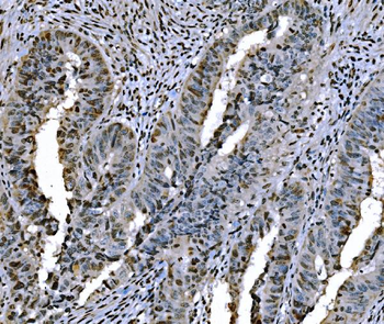 Anti-Histone H1.0/H1F0 Antibody (monoclonal, 5I3E6)