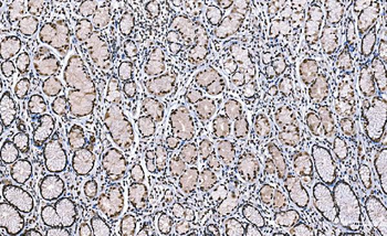 Anti-Histone H1.0/H1F0 Antibody (monoclonal, 5I3E6)