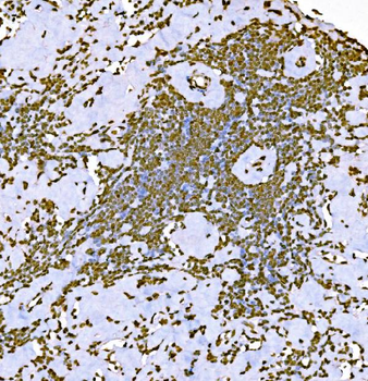 Anti-Histone H1.0/H1F0 Antibody (monoclonal, 5I3E6)
