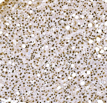 Anti-Histone H1.0/H1F0 Antibody (monoclonal, 5I3E6)