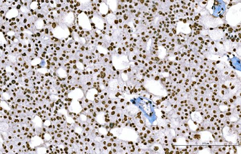 Anti-Histone H1.0/H1F0 Antibody (monoclonal, 5I3E6)
