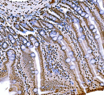 Anti-Histone H1.0/H1F0 Antibody (monoclonal, 5I3E6)