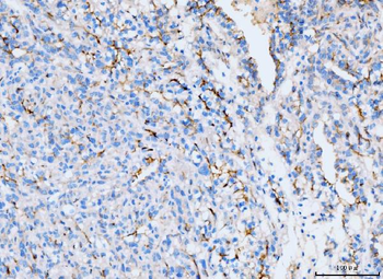 Anti-ICAM1 Antibody (monoclonal, 6F2C3)