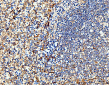Anti-ICAM1 Antibody (monoclonal, 6F2C3)