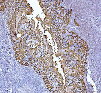 Anti-MASPIN Antibody (monoclonal, 7G4E1)