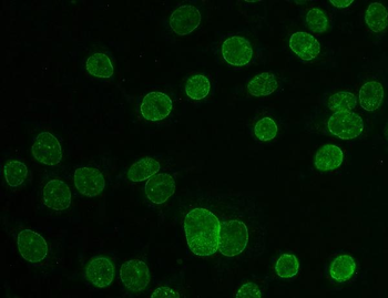 Anti-TPR Antibody