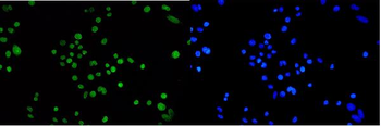 Anti-TPR Antibody