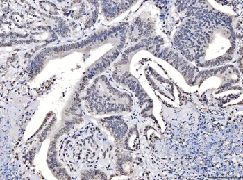 Anti-TPR Antibody