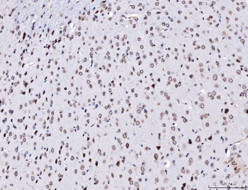 Anti-TPR Antibody