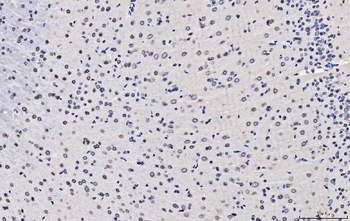 Anti-TPR Antibody