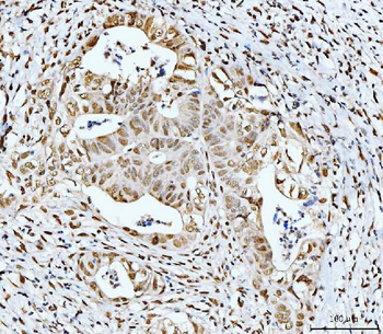 Anti-53BP1/TP53BP1 Antibody