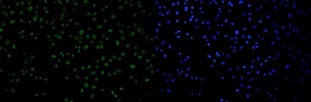 Anti-53BP1/TP53BP1 Antibody