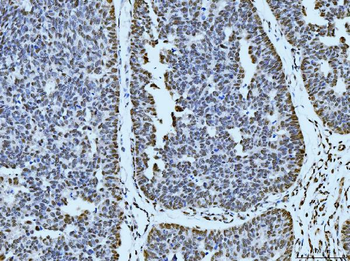 Anti-53BP1/TP53BP1 Antibody