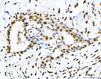 Anti-53BP1/TP53BP1 Antibody