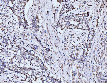 Anti-53BP1/TP53BP1 Antibody