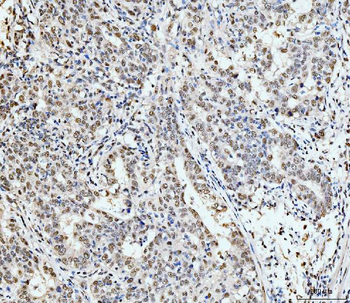 Anti-53BP1/TP53BP1 Antibody