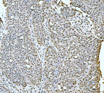 Anti-53BP1/TP53BP1 Antibody