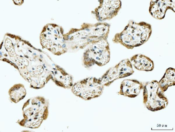 Anti-53BP1/TP53BP1 Antibody