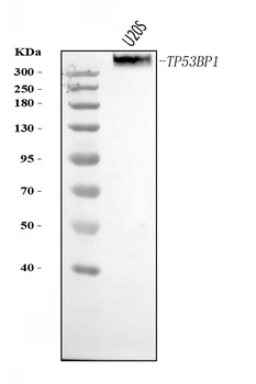 53BP1/TP53BP1 Antibody