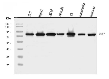 Anti-NAK/TBK1 Antibody