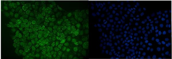 Anti-RANGAP1 Antibody