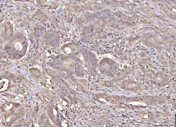 Anti-RANGAP1 Antibody