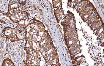 Anti-RAB5A/B/C Antibody