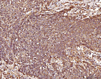 Anti-RAB5A/B/C Antibody