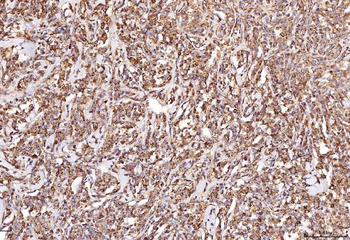 Anti-RAB5A/B/C Antibody