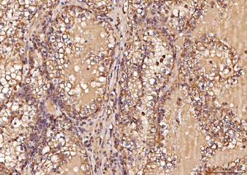 Anti-RAB5A/B/C Antibody
