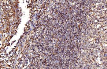 Anti-RAB5A/B/C Antibody