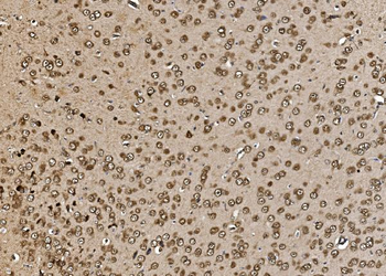 Anti-Proteasome 20S beta 7/PSMB7 Antibody