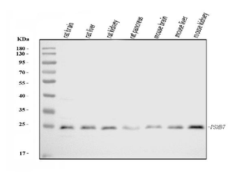Anti-Proteasome 20S beta 7/PSMB7 Antibody