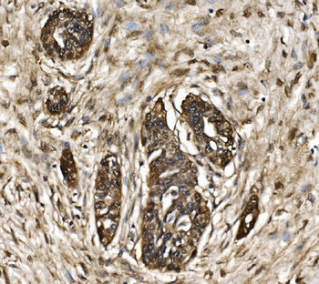 Anti-Proteasome 20S beta 7/PSMB7 Antibody