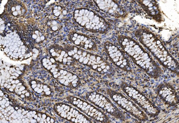 Anti-Proteasome 20S beta 7/PSMB7 Antibody