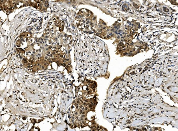 Anti-Proteasome 20S beta 7/PSMB7 Antibody