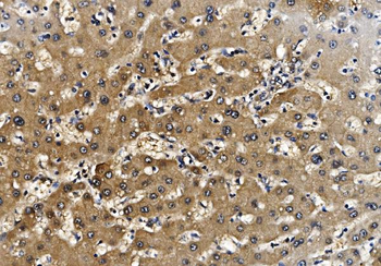 Anti-Proteasome 20S beta 7/PSMB7 Antibody