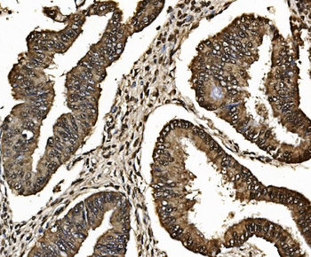 Anti-Proteasome 20S beta 7/PSMB7 Antibody