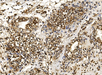 Anti-Proteasome 20S beta 7/PSMB7 Antibody