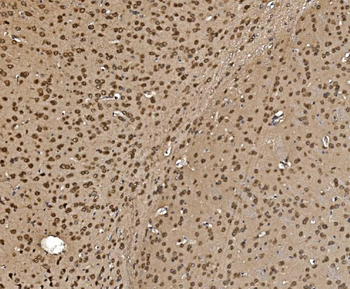 Anti-Proteasome 20S beta 7/PSMB7 Antibody