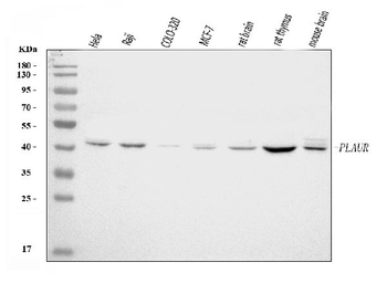 uPA Receptor/U-PAR/PLAUR/PAR Rabbit Polyclonal Antibody