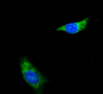 Anti-NDUFB8 Antibody