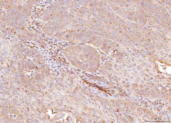 Anti-NDUFB8 Antibody