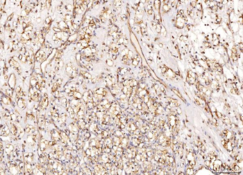 Anti-NDUFB8 Antibody