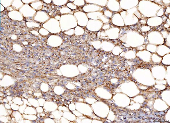 Anti-NDUFB8 Antibody