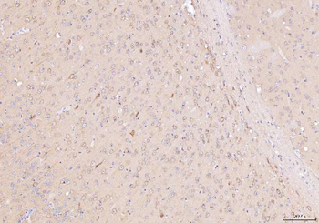 Anti-NDUFB8 Antibody